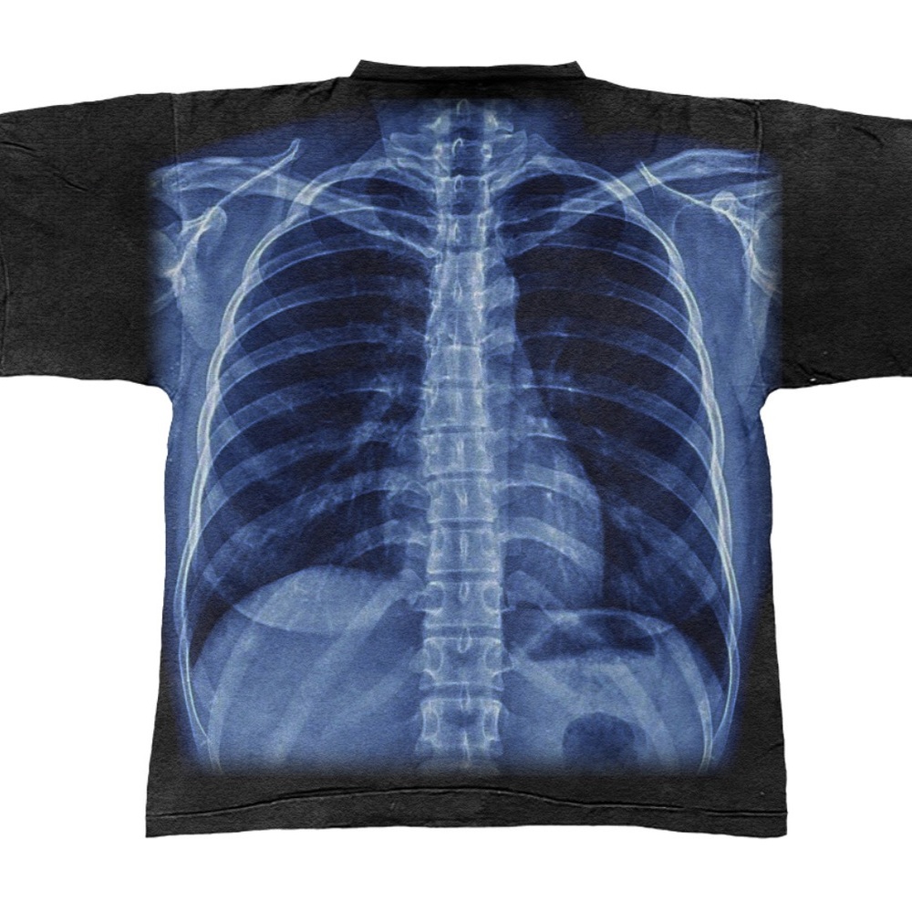 COPY - X-Ray Riches Tee - Picture 6 of 6